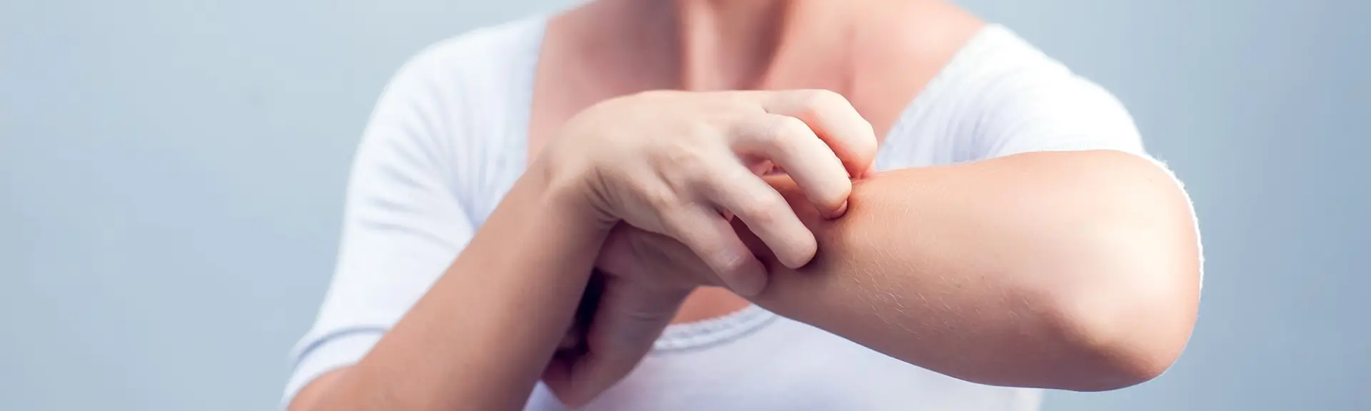 L’eczéma chez l’adulte : Approches naturopathiques