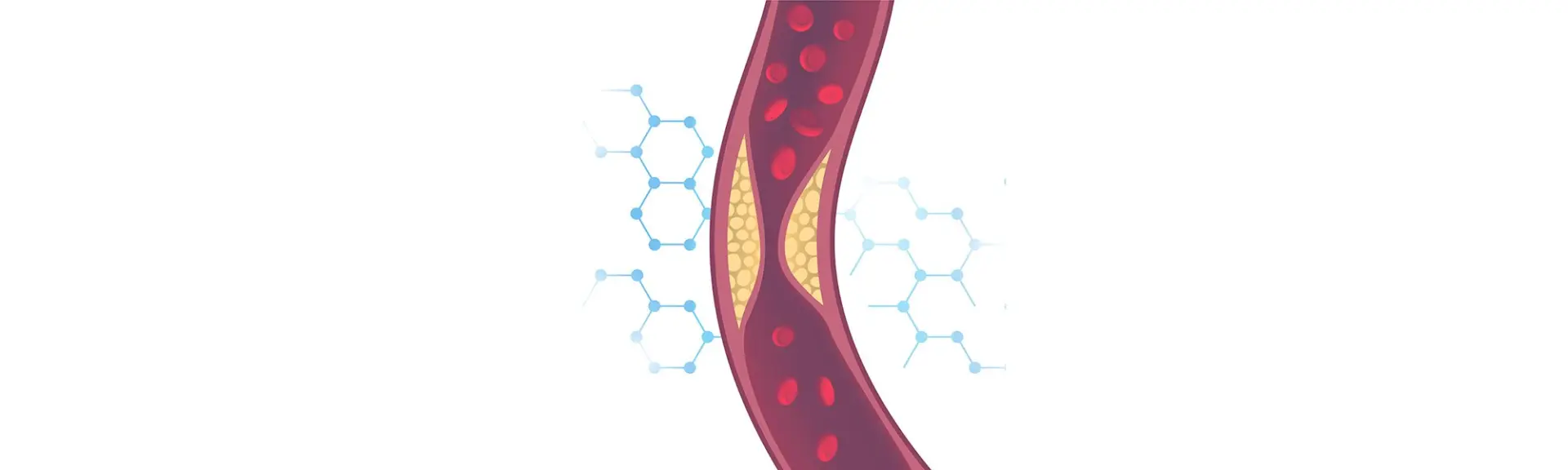 Cholestérol trop élevé ? Cinq actions éprouvées pour aider